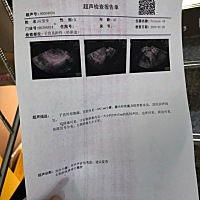 也要自己出钱，养女儿也是自己养，以后不再生二胎了！对不起了宝宝，求药流后到时候要注意什么啊！分居...