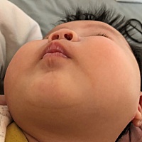 请问宝宝三个月嘴巴干，唾液粘粘的，有泡泡是上火喝水少的吗？？