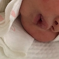 为什么我剖腹产会那么痛，我觉得是麻药没起作用，医生说我是那种疼痛比较敏感的人？会吗？有宝妈想我一...