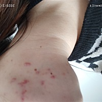 宝宝3个月22天小宝宝一出来脸上就很多这样小疙瘩到现在没去掉，之前怀孕没有生完宝宝就有了，怎么才能去...