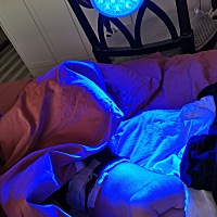 在家照蓝光。期待效果！