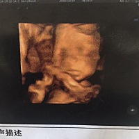 之前总觉得第二次四维照很丑，宝宝出生后才能看到他真实的相貌😄，我会努力做好一个合格专业的妈妈，...
