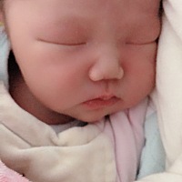 宝宝今天12天，刨腹产下来过两天下面有点硬肿，住了4天院回去，在家呆了两天又这样反复，宝妈们有遇到这...