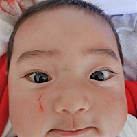 宝宝脸被指甲抓伤了涂什么药。平时都是怎么清洗，注意些什么事项，在线等