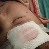 会走路又害怕，家婆带人两分钟更加害怕，又超包又出血害怕会不会留疤伤口不大