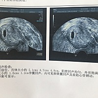 各位有经验的宝妈们，可以看出男女孩么？