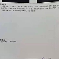 有经验的给看看男孩女孩呀😂太好奇了