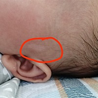 宝宝耳边有块白色的东西，不知道是什么，有人知道吗？可以告诉我