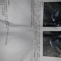 大家帮我看看报告 是不是怀孕了。在线等急