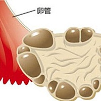 多囊卵巢综合征是一种以内分泌代谢紊乱为病理基础的妇科常见病。它的诊断和治疗都很复杂，主要是因为它...