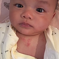 有宝妈知道这是啥吗？什么药有用？