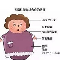 多囊卵巢综合征，是妇科门诊上比较常见的类型。相对来说，此病的症状是很典型的，很多人是由于月经异常...