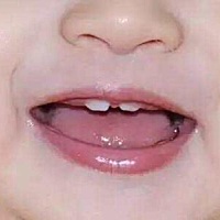 小孩子牙问题