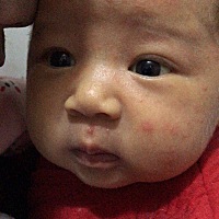 想问一下各位宝妈，孩子脸上起的这种痘痘是怎么回事，有什么办法可以控制