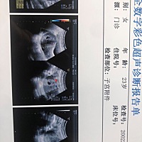 男孩女孩啊 大神告知