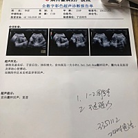 是男孩女孩