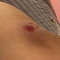 刚出月子，被家暴，是不是要离婚，被家暴的主要源头是床上掉了根鱼骨头，然后嫌弃我带宝宝不好，很累，...