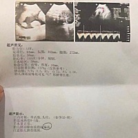 各位宝妈好，因为朋友第一胎是儿子，她想知道这二胎是男是女，请问有人知道吗？