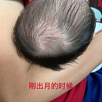 忽略分娩过程…前面7天请了月嫂，这个阿姨整体来说还可以，就是对于小孩的睡姿各有看法，她老是放小孩睡...