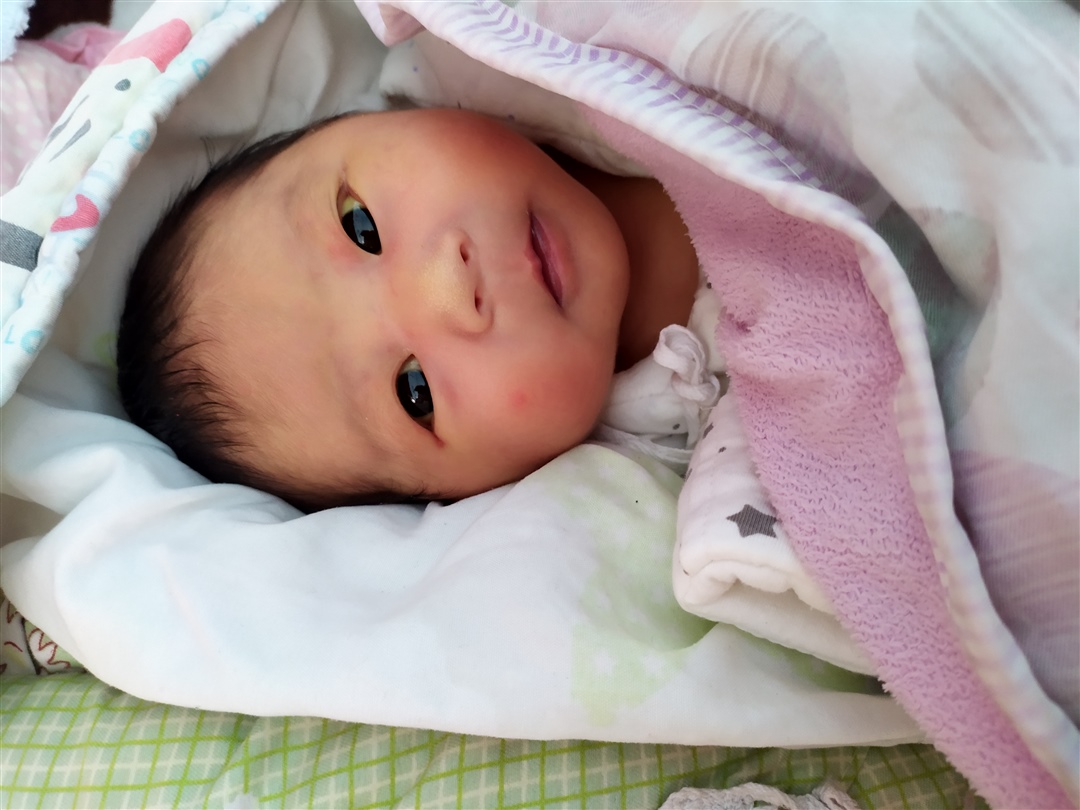 12天，黄疸有点高。捂的长湿疹了