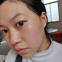 脸上长斑点了😭有没有什么好东西可以推荐