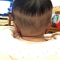 前面的长得很好，就后面剃了过后就一点没长