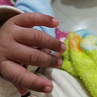 谁能告诉我宝宝出生，手指甲脚指甲边缘发黑怎么回事，正常吗？？