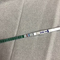 距离经期还有一天，最近胸骨一直疼，腰酸。涨奶，这是有了吗？什么时候去检查比较合适
