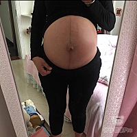剖腹产的术后第100天，今天也是儿子的百日宴，愿宝宝健康快乐每一天，生当天126斤，如今恢复到89斤，祝...