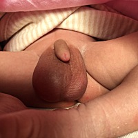 这样是正常的吗，孩子各种状况搞得自己都快崩溃了，坐月子哭了好多次了太郁闷了