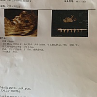 有没有看得出是男宝女宝的呀