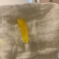 亲们，我家宝宝便秘，我就用肥皂切成小条，如下，蘸着水，让肥皂变润滑，宝宝肛门口涂点润滑油，轻轻塞...