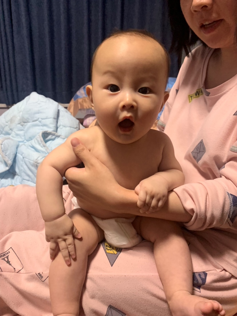这是好了以后，三天基本好了！现在都觉得好神奇😅
