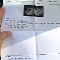 宝妈们有没有9周了还没有胚芽和心管搏动的？我好着急，我听她们说最晚十一周才有胚芽和心管搏动，这是不...