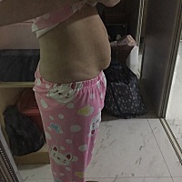 目前的肚子产不忍赌，看见心情就不好，一胎顺，这二胎剖腹产，当时伤口痛没有及时开奶，导致奶堵了，找...