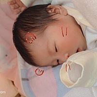 是个小米妮