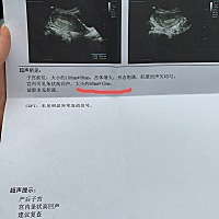 顺产第十天，突然出血很多，去医院检查说子宫有东西没有排出，医生建议清宫，我怕疼，没有清宫，开了药...