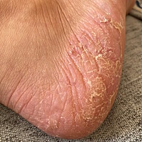 有没有宝妈和我一样呢？好几年了 补各种维生素 摸各种药都不管用 是不是缺铁还是缺什么，医院化验血 什...