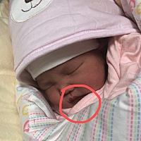 嘿嘿，3月1日横位剖腹产一女宝，5.6斤。术后滋味儿太酸爽，差点英年早逝！🤣还好，麻药技术到位，麻醉...