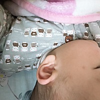 被蚊子咬的地方一个多月还有印，好难退，你们有这样的问题吗