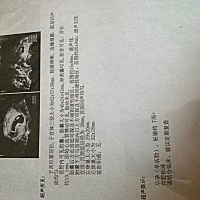 给大家泼几盆冷水！哈哈！ 生男生女除了做b超真的看不出来！ 刚怀孕的时候说七周看胎囊，长条是儿子圆形...
