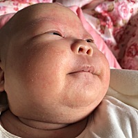 快两个月了最近脸上这样该如何是好.看着好难受.也不敢涂抹什么.有没有什么办法能解决.这个还要多久才能...