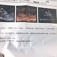 有没有人知道这是男孩女孩，心跳169次每分，拜托啦