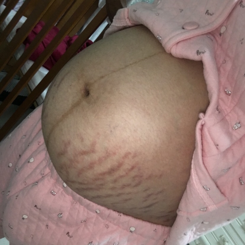 孕期小家伙特别懒，每次吃巧克力胎心监护才能过，一直以为是个姑娘，结果开奖是男孩😂