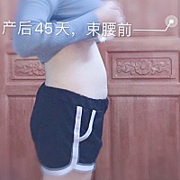 你们都恢复了吗？ 这个是我产后43天拍的照片，那时候就单纯想看看我的肚子到底还有多大 这是我第134天时...