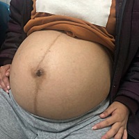 看过我肚子的都说我怀的又是个男孩子，你们觉得呢
