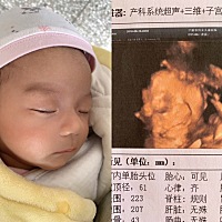 卓一晨  男宝宝 出生时 7斤3两  超快顺产  满月10斤5两   现在已经一个月23天了。现在把三维翻出来真的...