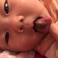 宝贝六个月了 舌头发黑多半个月了 请问各位宝妈怎么回事 啊？好着急