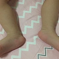 宝宝今天9个月了，还只有17斤，吃的也不少，精神状态也很好，不知道是不是缺点啥