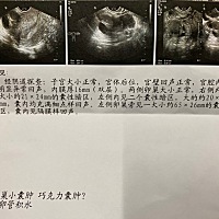 当女人好苦，生儿育女还要工作家务家庭都要顾着，这囊肿有人懂吗，吃药可以治愈好的吧？##妈妈的另一面#